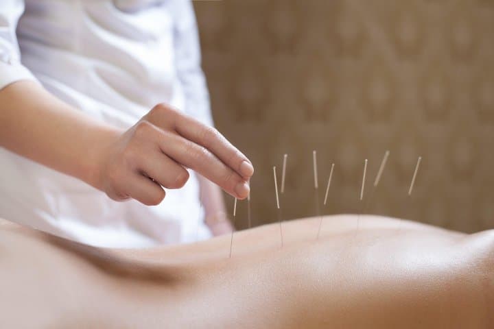 Acupunctuur4u