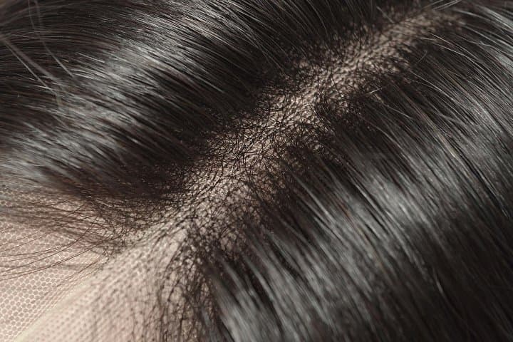 The Hairboost Clinic